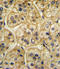 Adaptor Related Protein Complex 2 Subunit Alpha 2 antibody, LS-C156387, Lifespan Biosciences, Immunohistochemistry paraffin image 