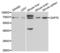 Zeta Chain Of T Cell Receptor Associated Protein Kinase 70 antibody, LS-C331979, Lifespan Biosciences, Western Blot image 