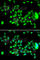 Hyaluronidase 3 antibody, A7011, ABclonal Technology, Immunofluorescence image 
