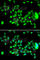 Hyaluronidase-3 antibody, A7011, ABclonal Technology, Immunofluorescence image 