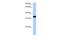 GTPase, IMAP Family Member 1 antibody, PA5-43539, Invitrogen Antibodies, Western Blot image 