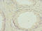 Glycogen Phosphorylase B antibody, LS-C211959, Lifespan Biosciences, Immunohistochemistry paraffin image 