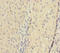 ATP Synthase F1 Subunit Delta antibody, A50065-100, Epigentek, Immunohistochemistry paraffin image 