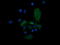 Mitogen-Activated Protein Kinase Kinase 3 antibody, LS-C787752, Lifespan Biosciences, Immunofluorescence image 