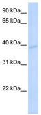 Potassium Channel Modulatory Factor 1 antibody, TA331836, Origene, Western Blot image 