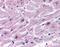 Cysteinyl Leukotriene Receptor 2 antibody, NLS3305, Novus Biologicals, Immunohistochemistry paraffin image 