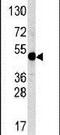 Transcription Factor AP-2 Alpha antibody, PA5-11817, Invitrogen Antibodies, Western Blot image 