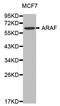 Aldehyde Dehydrogenase 1 Family Member A1 antibody, orb48279, Biorbyt, Western Blot image 