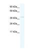 TATA-Box Binding Protein Associated Factor 7 Like antibody, NBP1-80292, Novus Biologicals, Western Blot image 