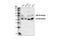 Ribosomal Protein S6 Kinase B1 antibody, 9202S, Cell Signaling Technology, Western Blot image 