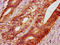 DEPP1 Autophagy Regulator antibody, LS-C680372, Lifespan Biosciences, Immunohistochemistry paraffin image 