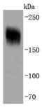 Platelet Derived Growth Factor Receptor Alpha antibody, NBP2-67025, Novus Biologicals, Western Blot image 