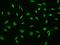 Cyclin Dependent Kinase 13 antibody, 205301-T02, Sino Biological, Immunohistochemistry paraffin image 