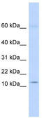 Keratin Associated Protein 8-1 antibody, TA338958, Origene, Western Blot image 