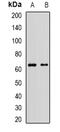 MLLT3 Super Elongation Complex Subunit antibody, abx141523, Abbexa, Western Blot image 
