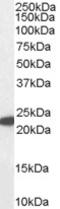 Glutathione peroxidase 1 antibody, EB07283, Everest Biotech, Western Blot image 