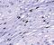 HPV antibody, ab2417, Abcam, Immunohistochemistry paraffin image 