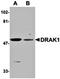 Serine/Threonine Kinase 17a antibody, orb74379, Biorbyt, Western Blot image 