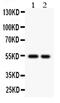 Cystatin A antibody, PA5-79081, Invitrogen Antibodies, Western Blot image 