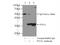 Partner Of NOB1 Homolog antibody, 21059-1-AP, Proteintech Group, Immunoprecipitation image 