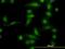 Aldo-Keto Reductase Family 1 Member B10 antibody, orb89792, Biorbyt, Immunofluorescence image 