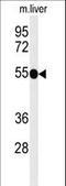 TNF Receptor Superfamily Member 8 antibody, LS-C162069, Lifespan Biosciences, Western Blot image 