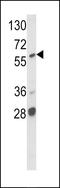 A-Raf Proto-Oncogene, Serine/Threonine Kinase antibody, 63-215, ProSci, Western Blot image 