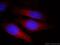 Tankyrase-1 antibody, 18030-1-AP, Proteintech Group, Immunofluorescence image 