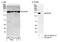 DExH-Box Helicase 9 antibody, NB110-40579, Novus Biologicals, Western Blot image 