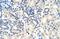 Poly(A) Binding Protein Cytoplasmic 4 antibody, GTX47371, GeneTex, Immunohistochemistry paraffin image 