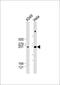 WNK1 antibody, 61-362, ProSci, Western Blot image 