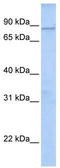 WD And Tetratricopeptide Repeats 1 antibody, TA333855, Origene, Western Blot image 