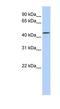 Leucine Rich Repeat Containing 28 antibody, NBP1-52848, Novus Biologicals, Western Blot image 