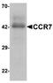 C-C Motif Chemokine Receptor 7 antibody, A00390, Boster Biological Technology, Western Blot image 