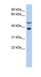Suppressor Of Cytokine Signaling 7 antibody, orb330724, Biorbyt, Western Blot image 