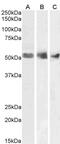 WT1 Transcription Factor antibody, PA5-18548, Invitrogen Antibodies, Western Blot image 