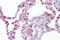 Hematopoietic Prostaglandin D Synthase antibody, ARP48763_P050, Aviva Systems Biology, Immunohistochemistry paraffin image 