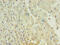 Alpha Fetoprotein antibody, CSB-MA027711A0m, Cusabio, Immunohistochemistry paraffin image 
