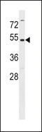 Methionine Adenosyltransferase 2A antibody, LS-B8768, Lifespan Biosciences, Western Blot image 