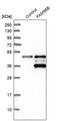 Family With Sequence Similarity 98 Member B antibody, PA5-52544, Invitrogen Antibodies, Western Blot image 