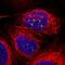 Tumor Protein P53 Binding Protein 1 antibody, NBP2-54677, Novus Biologicals, Immunofluorescence image 