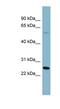 Glutaminyl-TRNA Amidotransferase Subunit QRSL1 antibody, NBP1-56621, Novus Biologicals, Western Blot image 