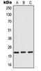 RAN Binding Protein 1 antibody, LS-C352752, Lifespan Biosciences, Western Blot image 