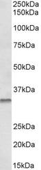 Caspase 6 antibody, STJ73022, St John