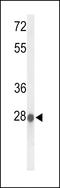 Abhydrolase Domain Containing 11 antibody, LS-C155881, Lifespan Biosciences, Western Blot image 