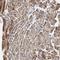 Non-SMC Condensin I Complex Subunit H antibody, NBP1-88345, Novus Biologicals, Immunohistochemistry frozen image 