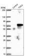 Transmembrane Channel Like 4 antibody, PA5-61788, Invitrogen Antibodies, Western Blot image 