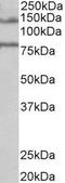 Erythrocyte Membrane Protein Band 4.1 Like 5 antibody, GTX88887, GeneTex, Western Blot image 