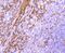 Heat Shock Protein Family B (Small) Member 1 antibody, NBP2-67896, Novus Biologicals, Immunohistochemistry paraffin image 