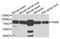 P21 (RAC1) Activated Kinase 6 antibody, orb373787, Biorbyt, Western Blot image 
